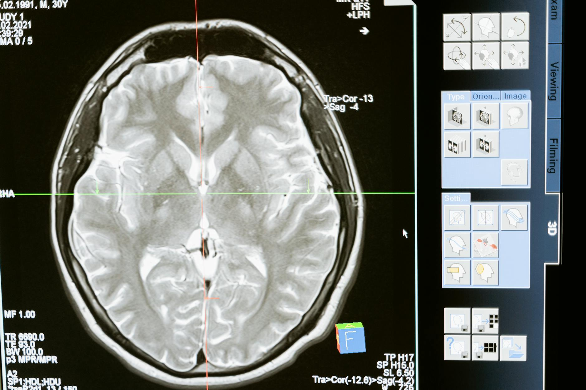 How Your Brain Filters Reality Without You Realizing